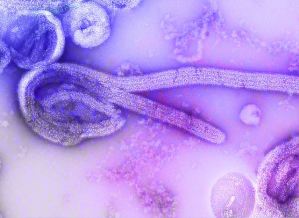 SP descarta segundo caso suspeito de ebola; paciente segue internada